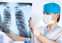 Возобновлено массовое профилактическое рентгенологическое обследование населения